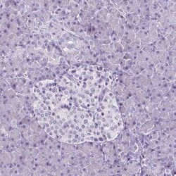 SLC22A2/OCT2 Antibody (CL0631), Novus Biologicals 25 &mu;L, Unconjugated:Antibodies,
