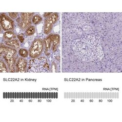 SLC22A2/OCT2 Antibody (CL0631), Novus Biologicals 25 &mu;L, Unconjugated:Antibodies,