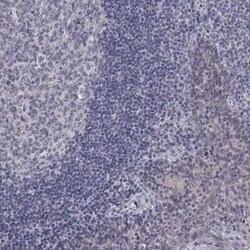 SLC22A2/OCT2 Rabbit anti-Human, Polyclonal, Novus Biologicals 25 &mu;g;