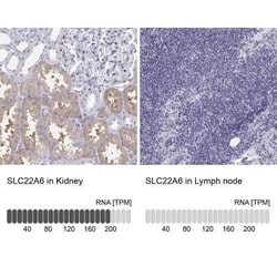 OAT1 Antibody, Novus Biologicals 25ul; Unconjugated:Antibodies, Polyclonal