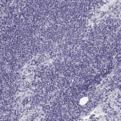 OAT1 Antibody, Novus Biologicals 25ul; Unconjugated:Antibodies, Polyclonal