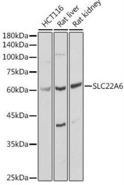 OAT1 Antibody - BSA Free, Novus Biologicals 0.02 mL; Unconjugated:Antibodies,