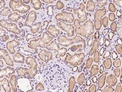 SLC22A7 Antibody, Novus Biologicals 100 &mu;g, Unconjugated:Antibodies,