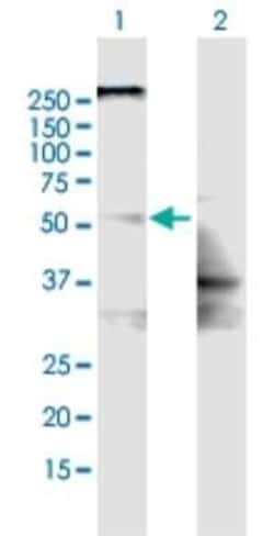 SLC22A8 Antibody, Novus Biologicals 0.05 mg | Buy Online | Novus Biologicals | Fisher Scientific