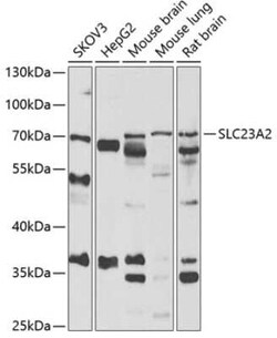 SLC23A2 Antibody - Azide and BSA Free, Novus Biologicals 0.02 mL; Unconjugated:Antibodies,