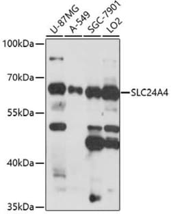 SLC24A4 Antibody - Azide and BSA Free, Novus Biologicals 0.02 mL, Unconjugated:Antibodies,