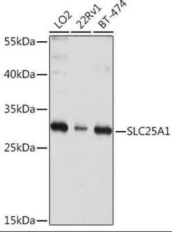 SLC25A1 Antibody - BSA Free, Novus Biologicals 0.02 mL, Unconjugated:Antibodies,