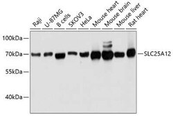 SLC25A12 Antibody - Azide and BSA Free, Novus Biologicals 0.02 mL; Unconjugated:Antibodies,