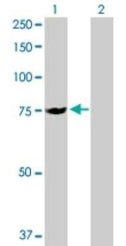 SLC25A13 Antibody, Novus Biologicals 0.1 mg | Buy Online | Novus Biologicals | Fisher Scientific