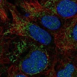 SLC25A18 Rabbit anti-Human, Polyclonal, Novus Biologicals:Antibodies:Primary