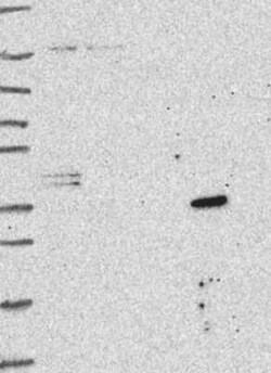 SLC25A18 Rabbit anti-Human, Polyclonal, Novus Biologicals:Antibodies:Primary