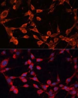 SLC25A19 Antibody - Azide and BSA Free, Novus Biologicals:Antibodies:Primary