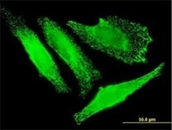 SLC25A20 Antibody (M2), Novus Biologicals 0.1 mg | Buy Online | Novus Biologicals | Fisher Scientific