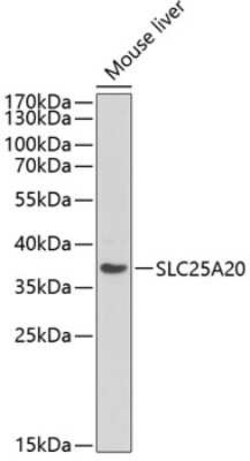 SLC25A20 Antibody - Azide and BSA Free, Novus Biologicals 0.02 mL | Buy Online | Novus Biologicals | Fisher Scientific