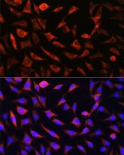 SLC25A22 Antibody - Azide and BSA Free, Novus Biologicals 0.1 mL; Unconjugated:Antibodies,