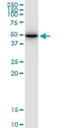 SLC25A24 Antibody, Novus Biologicals 0.05 mg, Unconjugated:Antibodies,