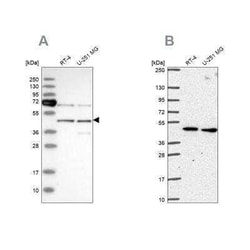 SLC25A24 Antibody, Novus Biologicals 25 &mu;L; Unconjugated:Antibodies,