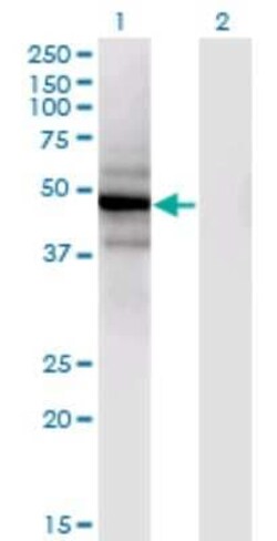 SLC25A25 Antibody (4D8), Novus Biologicals 0.1 mg | Buy Online | Novus Biologicals | Fisher Scientific
