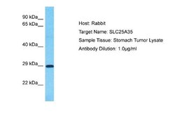 SLC25A35 Rabbit anti-Human, Polyclonal, Novus Biologicals 0.1 mL | Buy Online | Novus Biologicals | Fisher Scientific