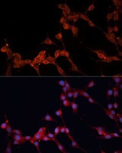 SLC25A38 Antibody - Azide and BSA Free, Novus Biologicals 0.1 mL; Unconjugated:Antibodies,