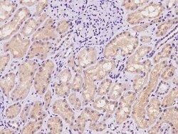 SLC25A41 Antibody, Novus Biologicals 100 &mu;g | Buy Online | Novus Biologicals | Fisher Scientific