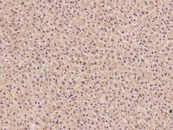 SLC25A41 Antibody, Novus Biologicals 100 &mu;g | Buy Online | Novus Biologicals | Fisher Scientific