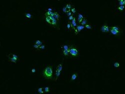 SLC25A42 Antibody, Novus Biologicals:Antibodies:Primary Antibodies