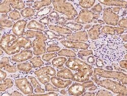 SLC25A42 Antibody, Novus Biologicals:Antibodies:Primary Antibodies