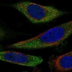 SLC25A43 Rabbit anti-Human, Polyclonal, Novus Biologicals 100 &mu;g | Buy Online | Novus Biologicals | Fisher Scientific