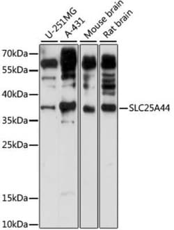 SLC25A44 Antibody - Azide and BSA Free, Novus Biologicals 0.02 mL; Unconjugated:Antibodies,