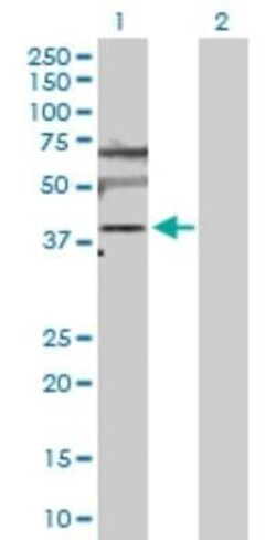 SLC25A6 Antibody, Novus Biologicals 0.1 mg | Buy Online | Novus Biologicals | Fisher Scientific