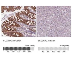 SLC26A2 Antibody, Novus Biologicals 25 &mu;L, Unconjugated:Antibodies,