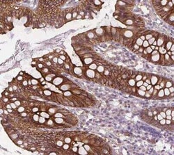 SLC26A2 Antibody, Novus Biologicals 25 &mu;L, Unconjugated:Antibodies,