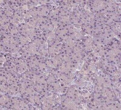 SLC26A2 Antibody, Novus Biologicals 25 &mu;L, Unconjugated:Antibodies,