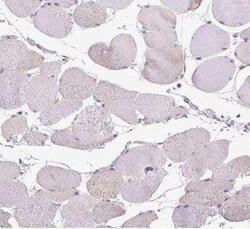 SLC26A2 Antibody, Novus Biologicals 25 &mu;L, Unconjugated:Antibodies,