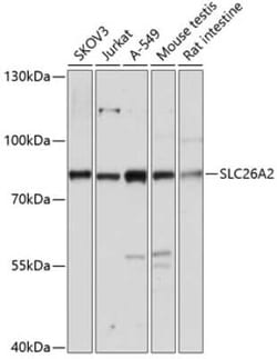 SLC26A2 Antibody - Azide and BSA Free, Novus Biologicals:Antibodies:Primary