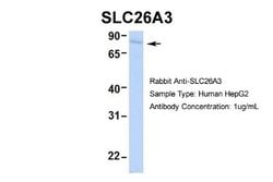 SLC26A3 Rabbit anti-Human, Polyclonal, Novus Biologicals 0.1ml; Unconjugated:Antibodies,