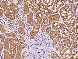 SLC26A6 Antibody, Novus Biologicals 100 &mu;g | Buy Online | Novus Biologicals | Fisher Scientific