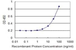 SLC28A2 Antibody (2D3), Novus Biologicals 0.1 mg | Buy Online | Novus Biologicals | Fisher Scientific