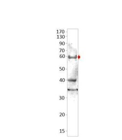 SLC29A3 Antibody, Novus Biologicals 100 &mu;g | Buy Online | Novus Biologicals | Fisher Scientific