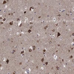 SLC2A13 Rabbit anti-Human, Polyclonal, Novus Biologicals:Antibodies:Primary