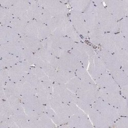 SLC2A13 Rabbit anti-Human, Polyclonal, Novus Biologicals:Antibodies:Primary