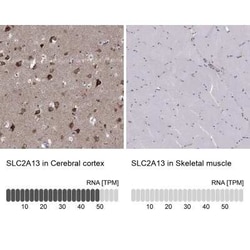 SLC2A13 Rabbit anti-Human, Polyclonal, Novus Biologicals:Antibodies:Primary