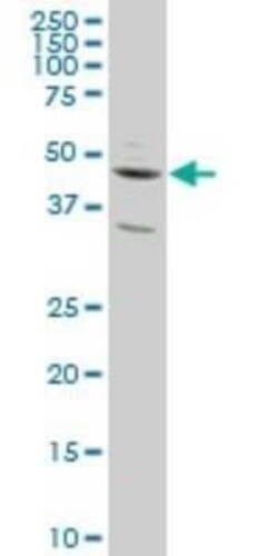 SLC2A4RG Antibody (4C10), Novus Biologicals 0.1 mg | Buy Online | Novus Biologicals | Fisher Scientific