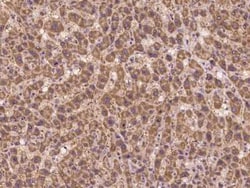 SLC2A7 Antibody, Novus Biologicals:Antibodies:Primary Antibodies