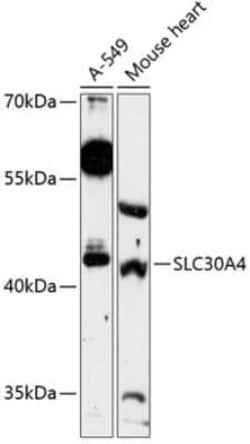 SLC30A4 Antibody - Azide and BSA Free, Novus Biologicals 0.1 mL; Unconjugated:Antibodies,