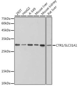 SLC31A1/CTR1 Rabbit anti-Human, Mouse, Rat, Clone: 4C10C5, Novus Biologicals