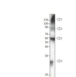 SLC31A1/CTR1 Antibody, Novus Biologicals 100 &mu;g | Buy Online | Novus Biologicals | Fisher Scientific