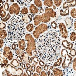 SLC34A1 Antibody (10B1.3E9) - BSA Free, Novus Biologicals:Antibodies:Primary