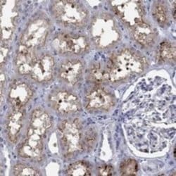 SLC34A1 Rabbit anti-Human, Polyclonal, Novus Biologicals 100 &mu;g; Unconjugated:Antibodies,